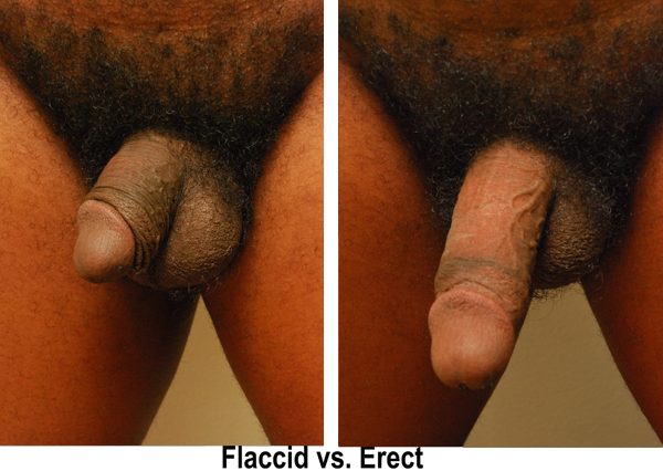best of Erect penis flaccid